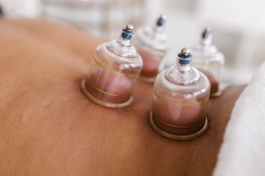 Hijama and therapeutic care